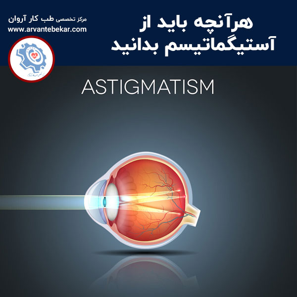 هرآنچه باید از آستیگماتیسم بدانید | طب کار آروان ⭐️